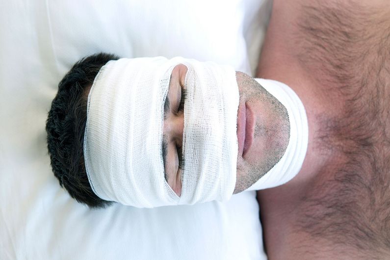 «Alors qu’on croyait que les troubles du sommeil et de l’éveil chez les patients hospitalisés en raison d’un traumatisme crânien grave étaient principalement causés par l’environnement hospitalier et les médicaments, cette étude nous montre que les atteintes neurologiques et l’altération de l’état de conscience sont les facteurs qui expliquent le mieux ces problèmes du cycle éveil-sommeil.» «Alors qu’on croyait que les troubles du sommeil et de l’éveil chez les patients hospitalisés en raison d’un traumatisme crânien grave étaient principalement causés par l’environnement hospitalier et les médicaments, cette étude nous montre que les atteintes neurologiques et l’altération de l’état de conscience sont les facteurs qui expliquent le mieux ces problèmes du cycle éveil-sommeil.»