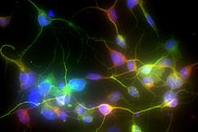 Photo de neurones reprogrammés par Janelle Drouin-Ouellet à partir de cellules de peau de patients atteints de la maladie de Parkinson. Les noyaux cellulaires sont marqués en bleu, tandis que les marquages vert et rouge montrent deux protéines exprimées dans des neurones matures.