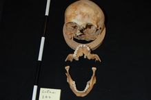 Pour tester empiriquement le potentiel d’identification de la méthode, les cherheurs ont sélectionné six squelettes d’individus mâles non identifiés ayant été exhumés au fil des années de quatre cimetières historiques du Québec.