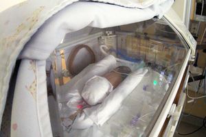 Premature baby receiving care at CHU Sainte-Justine children’s hospital