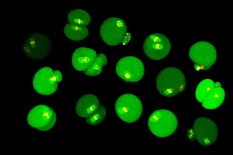 The choreography of cell division goes awry in the eggs of older mice and causes errors in the sharing of chromosomes.