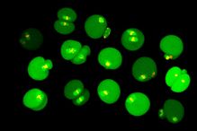 Dans les ovules de souris âgées, la chorégraphie de la division cellulaire dérape et cela entraîne des erreurs dans le partage des chromosomes.