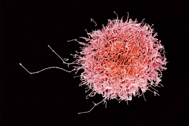 Les cellules tueuses naturelles font partie du système immunitaire et permettent d’éliminer les cellules cancéreuses ou les cellules infectées par des virus.