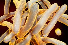 Mycobacterium tuberculosis, the bacterium that causes TB.
