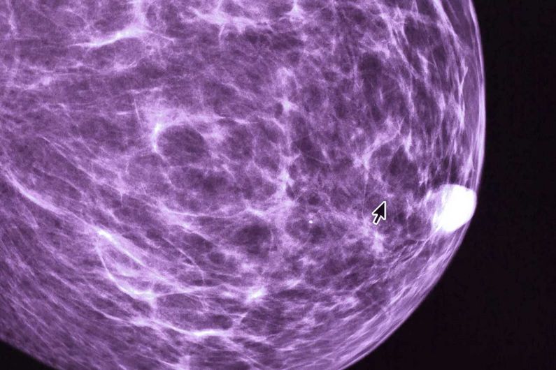 Mammography.