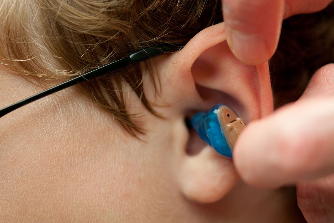 Hearing video. Слуховой аппарат. Внутренний слуховой аппарат. Внутриканальный слуховой аппарат. Наушники слуховой аппарат.