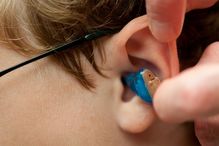 Le port d’une prothèse auditive permet de réduire le risque de chute chez les personnes atteintes de surdité ayant aussi une déficience du système vestibulaire, situé dans l'oreille interne.