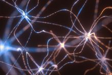 L’équipe de Frédéric Charron a récemment mis en lumière un mécanisme qui guide nos neurones afin de construire les délicats circuits du système nerveux.