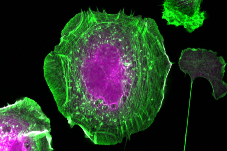 Filaments d’actine (en vert) et protéines biotinylées (en magenta) d’une cellule HeLa exprimant la sonde d’interaction de proximité BirA*-Flag-RAC1.