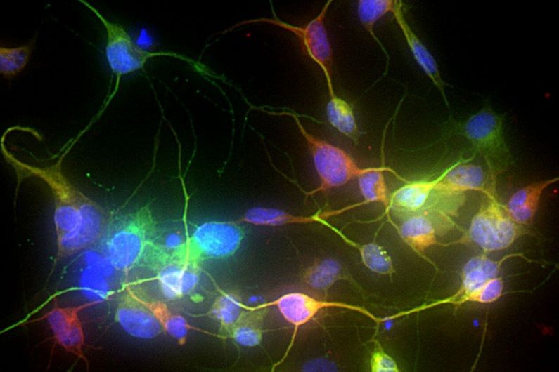 Photo de neurones reprogrammés par Janelle Drouin-Ouellet à partir de cellules de peau de patients atteints de la maladie de Parkinson. Les noyaux cellulaires sont marqués en bleu, tandis que les marquages vert et rouge montrent deux protéines exprimées dans des neurones matures.