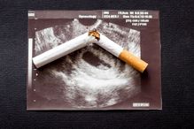 L’Organisation mondiale de la santé a désigné le tabac comme l’une des principales causes de mortalité que des mesures de prévention peuvent atténuer.