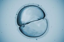 À moyen terme, cette découverte, encore au stade de la recherche fondamentale et faite en laboratoire sur des souris, pourrait être appliquée en clinique pour augmenter la performance des ovules utilisés lors d’une fécondation in vitro.