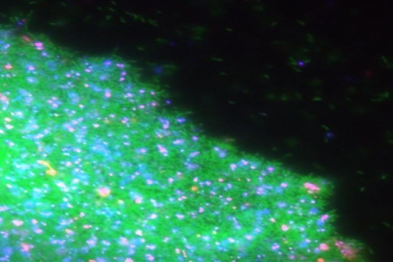 Image de fluorescence d'un biofilm de «Caulobacter». Les cellules vivantes sont marquées en vert, les cellules mortes en rose et la libération d'ADN extracellulaire pendant la mort cellulaire est représentée en bleu.