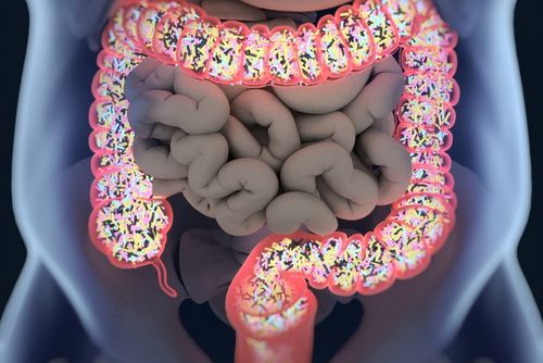 Colorectal Cancer Surgery: Gut Microbiota Helps Healing | UdeMNouvelles