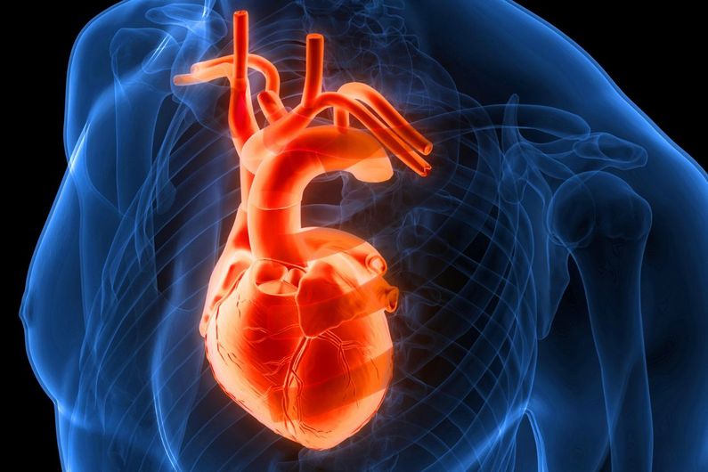 La fibrillation auriculaire est l'arythmie cardiaque la plus courante et elle est associée à des risques accrus d'insuffisance cardiaque, d'accident vasculaire cérébral et de démence.