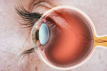 Given the pressing need to develop therapeutic interventions against vision loss, researchers around the world are testing different ways to repair damaged macula.