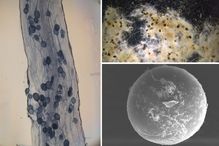 Photo à gauche: Racine mycorhizée montrant des vésicules et des hyphes intra-racinaire; photo en haut à droite: Hyphes et spores extraits; photo en bas à droite: Spore de champignon mycorhizien.