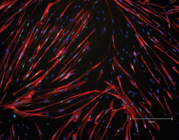 Des cellules musculaires humaines affectées par la DM1