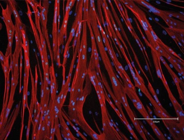 Des cellules musculaires humaines saines