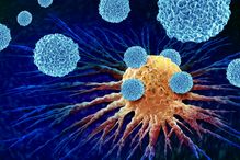 L’immunothérapie a révolutionné le traitement du cancer en mobilisant le système immunitaire pour attaquer les cellules tumorales.