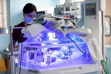 One of the main challenges is to quickly assess the extent of brain injury in order to anticipate the risk of long-term complications or, conversely, the potential for full recovery.