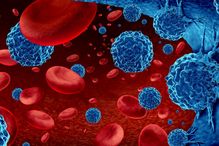 Au cours d’essais cliniques concluants sur plusieurs personnes atteintes d’un cancer du sang, l’utilisation de la molécule UM171 a beaucoup réduit les taux de rejet de greffe et la mortalité.