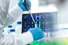 Cette initiative découle du contexte pandémique dans lequel les pays riches ont refusé de donner accès à des doses de vaccins à des prix abordables, causant de 200 000 à 1,3 million de morts dans les pays à revenus faibles et intermédiaires de 2019 à 2021.