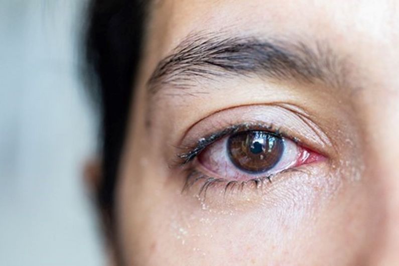 À titre d’ophtalmologiste au Centre universitaire d’ophtalmologie de l’hôpital Maisonneuve-Rosemont, la Dre Marie-Josée Aubin est régulièrement confrontée à des cas de syphilis, puisque la maladie peut également toucher les yeux.
