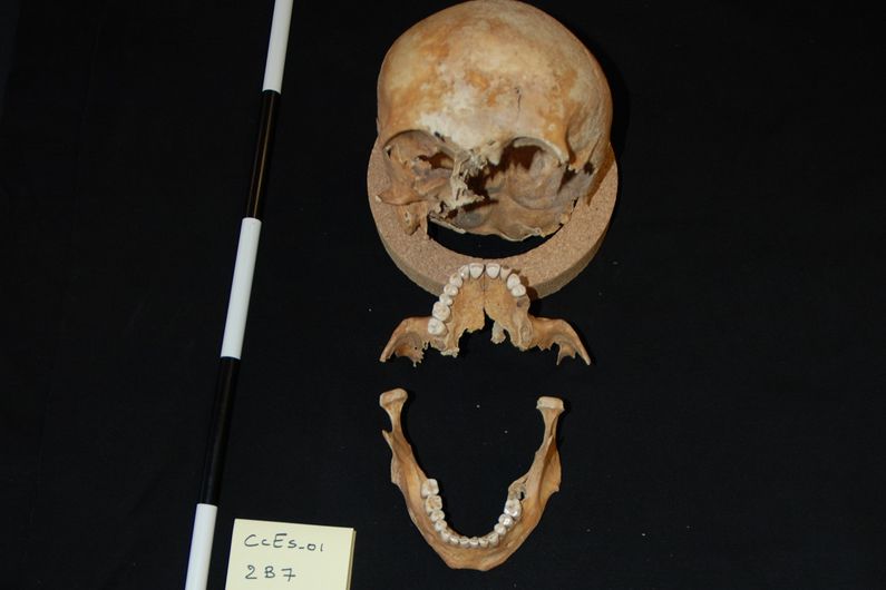 Pour tester empiriquement le potentiel d’identification de la méthode, les cherheurs ont sélectionné six squelettes d’individus mâles non identifiés ayant été exhumés au fil des années de quatre cimetières historiques du Québec.