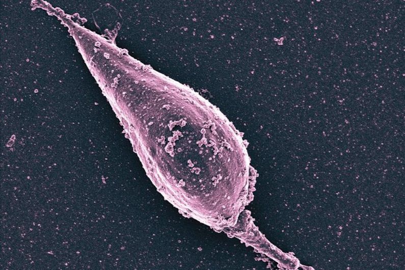 Image réalisée grâce à la microscopie électronique à balayage montrant la libération de vésicules extracellulaires à la surface d’un parasite Leishmania.