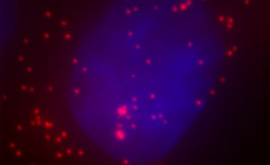 Cellule cancéreuse humaine avec molécules d'ARN messager (points rouge)