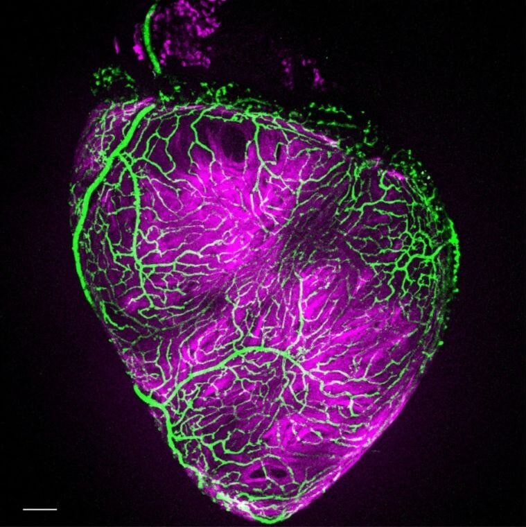 Cette vue du ventricule met en évidence la progression parallèle des vaisseaux coronaires et du tissu musculaire cardiaque, chacun marqué par une couleur fluorescente distincte qui permet de suivre leur maturation conjointe. 