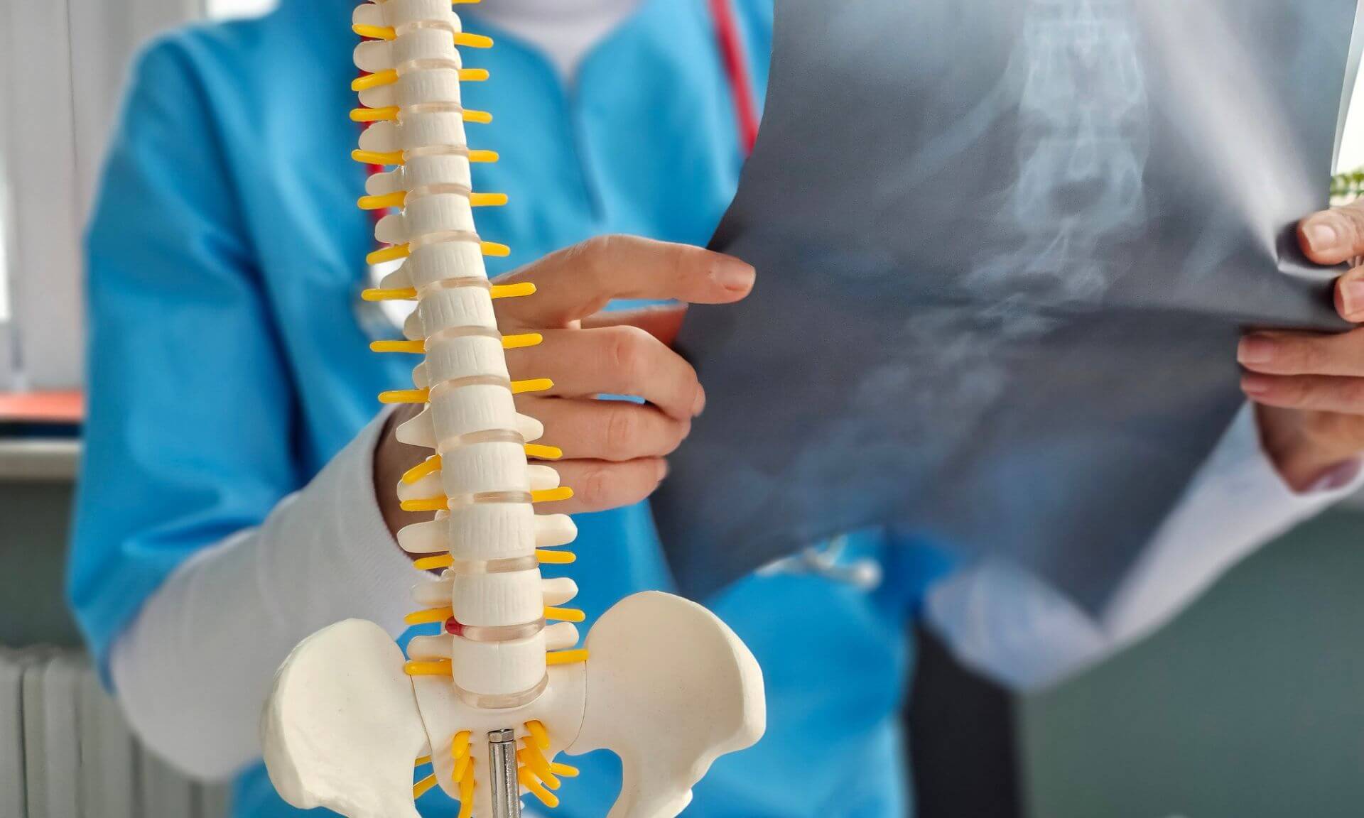 Selon les chercheurs, la scoliose ne se limite pas à une courbure visible sur une radiographie de face. 