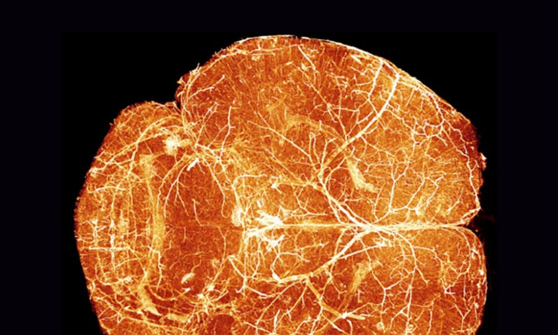 The cerebral blood vessels of a baby mouse. 