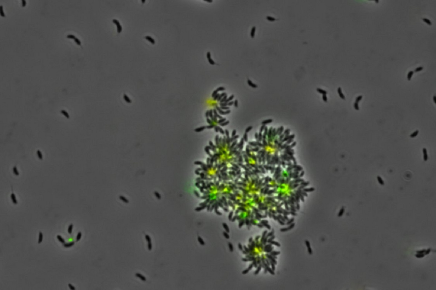 Ensemble de cellules bactériennes de «Caulobacter» attachées ensemble par leur substance adhésive (le «holdfast»), colorée en vert.
