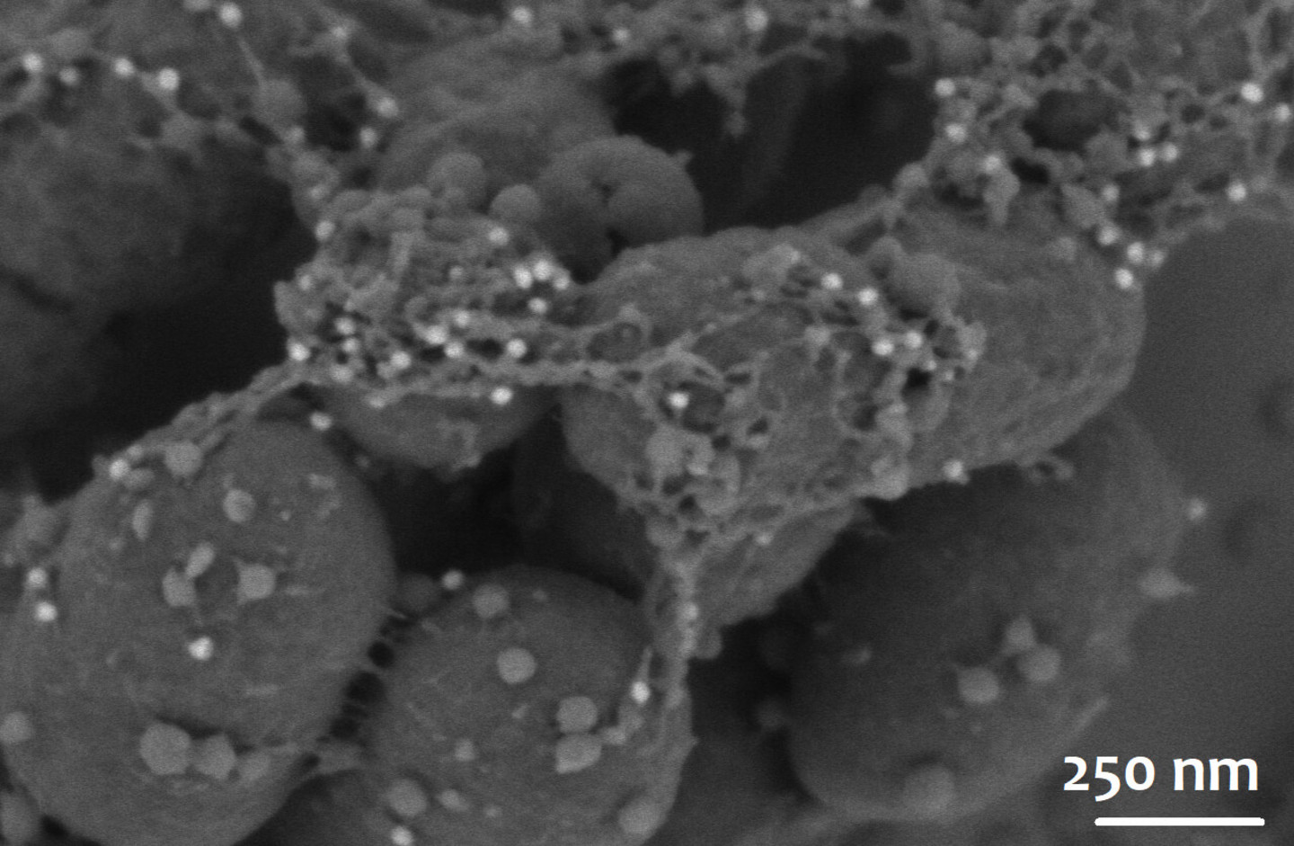 Immunomarquage à l’or colloïdal (billes blanches) pour la protéine SCPPPQ1 visualisé au microscope électronique à balayage, montrant l’interaction intime de la protéine avec les bactéries «P. gingivalis».