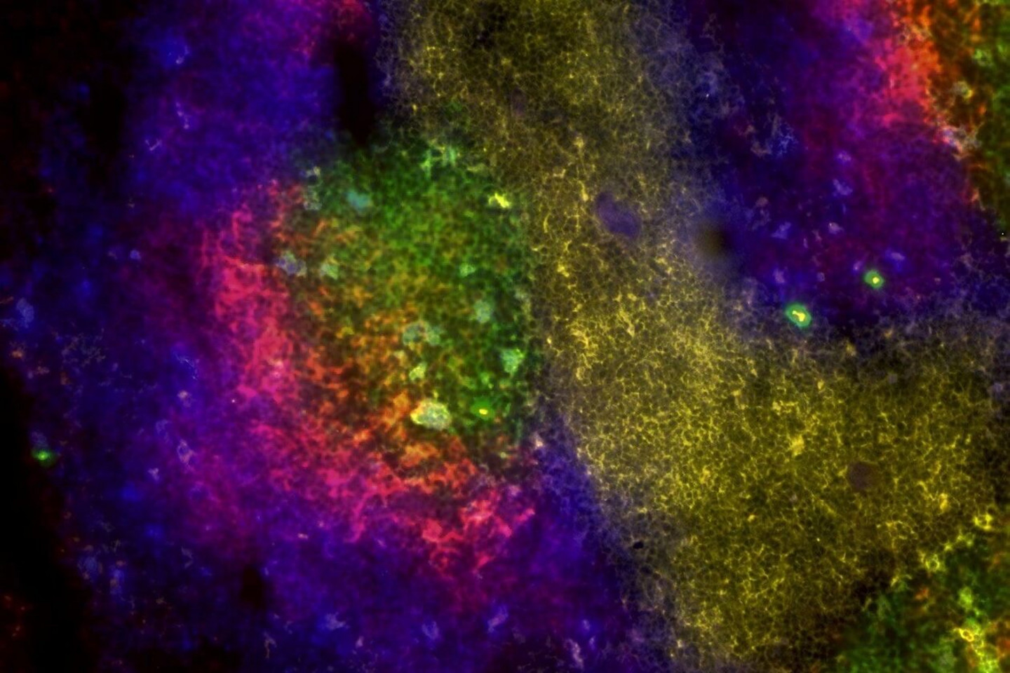 «Univers immunitaire», d'Anne-Marie Aubin, de l'Université de Montréal