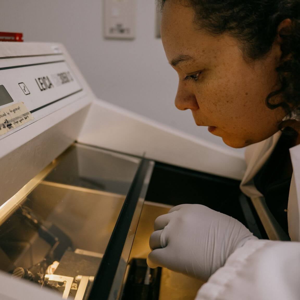 Spécialiste de la sclérose latérale amyotrophique (SLA), Alicia Dubinski s’est intéressée au rôle des granules de stress et de la pathologie TDP-43 dans la mort progressive des motoneurones. 