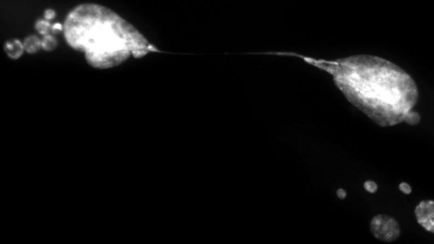 Le ballet de deux cellules vieillissantes entourées de micronoyaux et retenues par un pont chromosomique qui les unit dans la sénescence. 