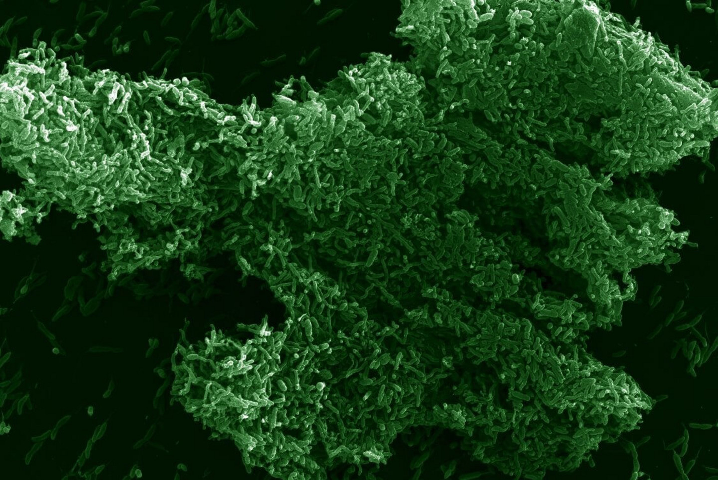 Attached Caulobacter cells forming a biofilm around a dust particle.